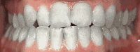 5b.jpg
